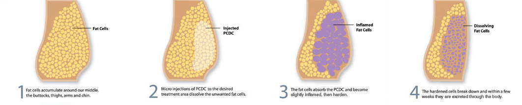 肝得健 lipodissolve injection 注射剂 问题线上解惑 台中教主医美