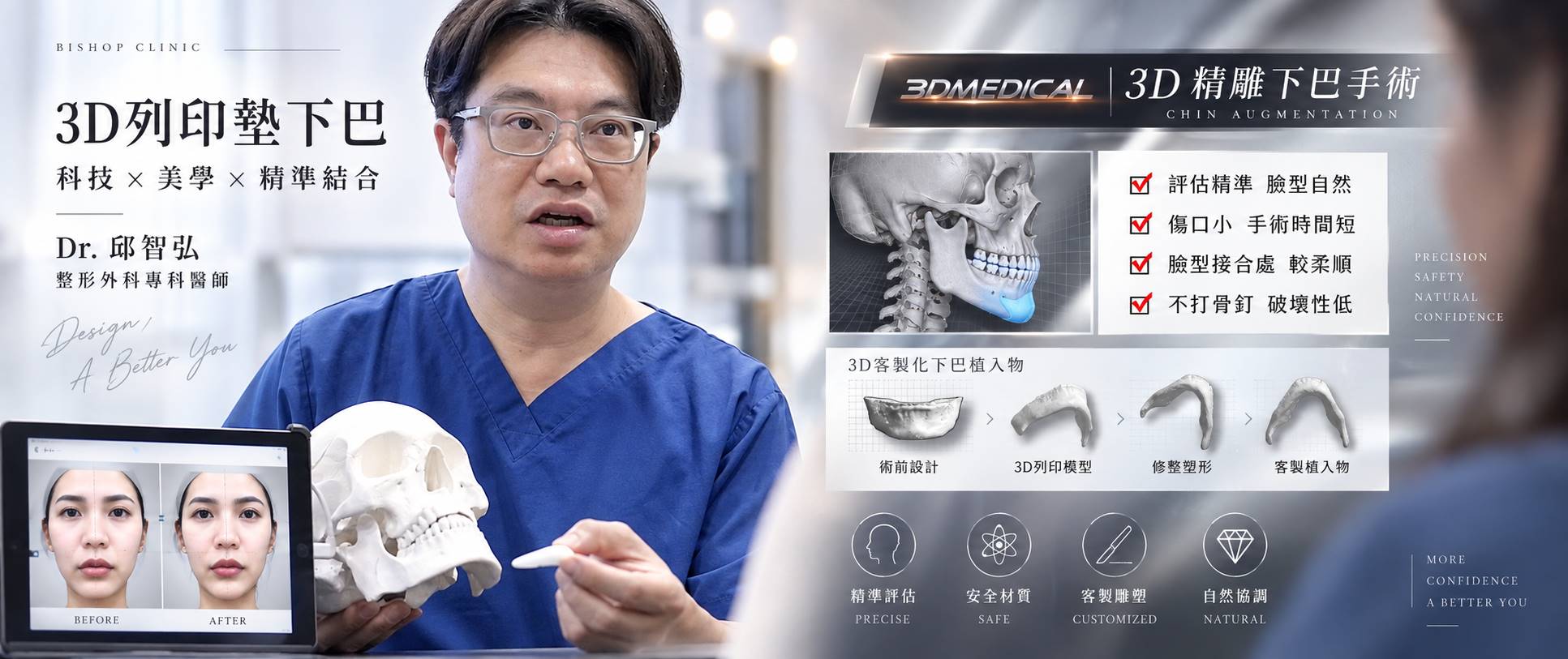 台中墊下巴整形手術推薦醫師診所價格費用介紹03