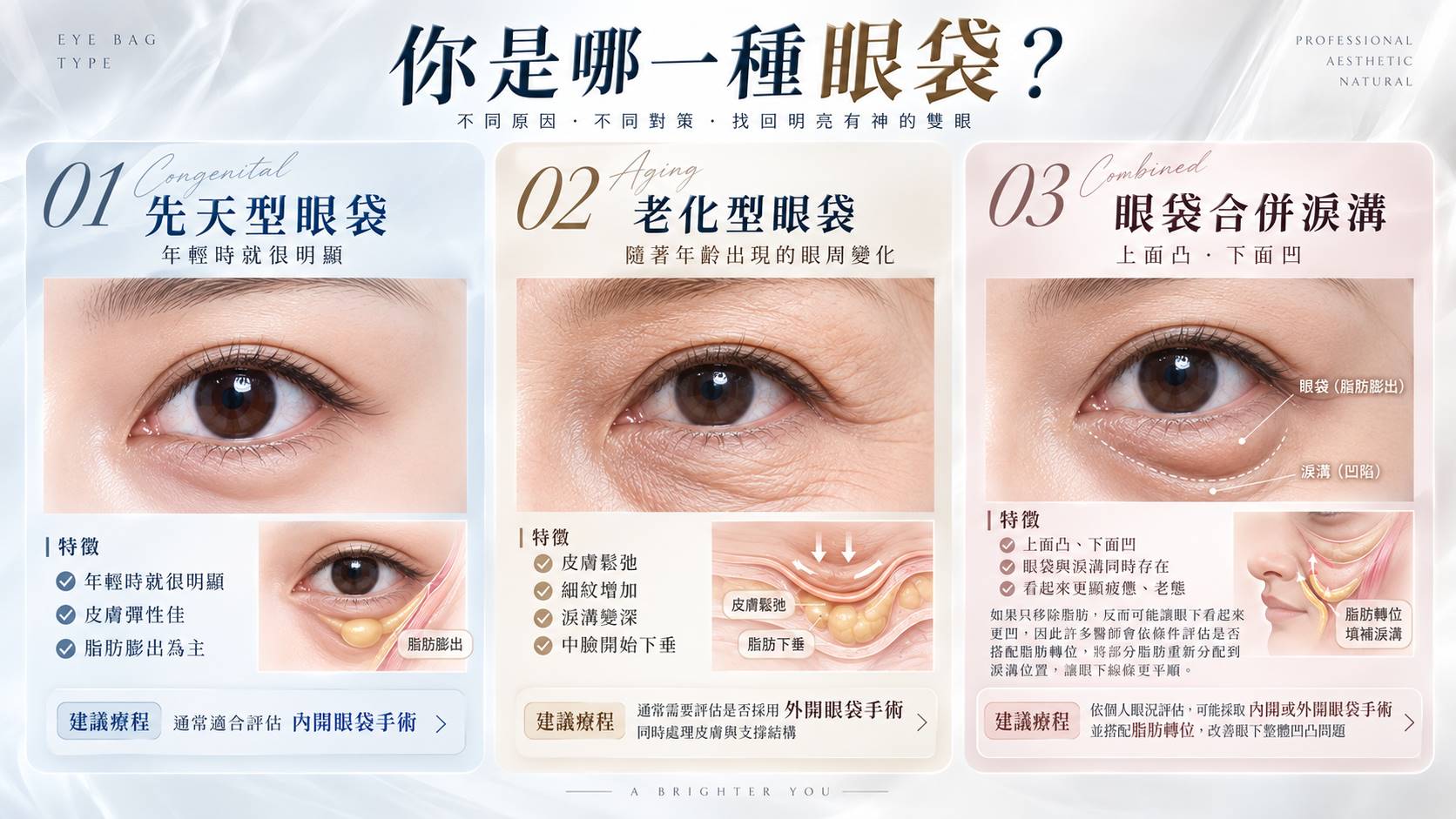 你是哪一種眼袋？ - 台中教主醫美