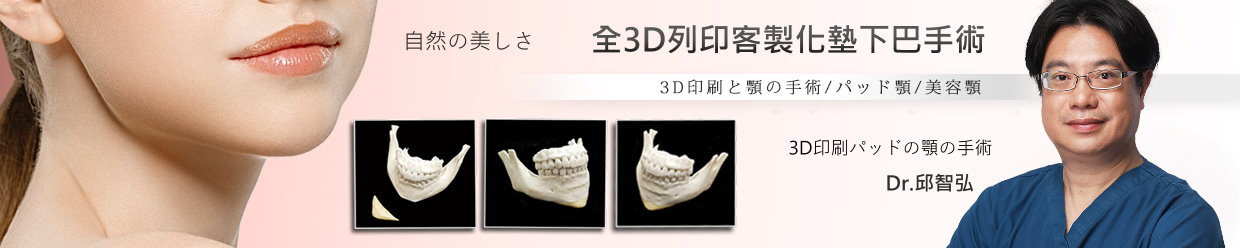全3D列印墊下巴手術 - 全程3D列印墊下巴技術